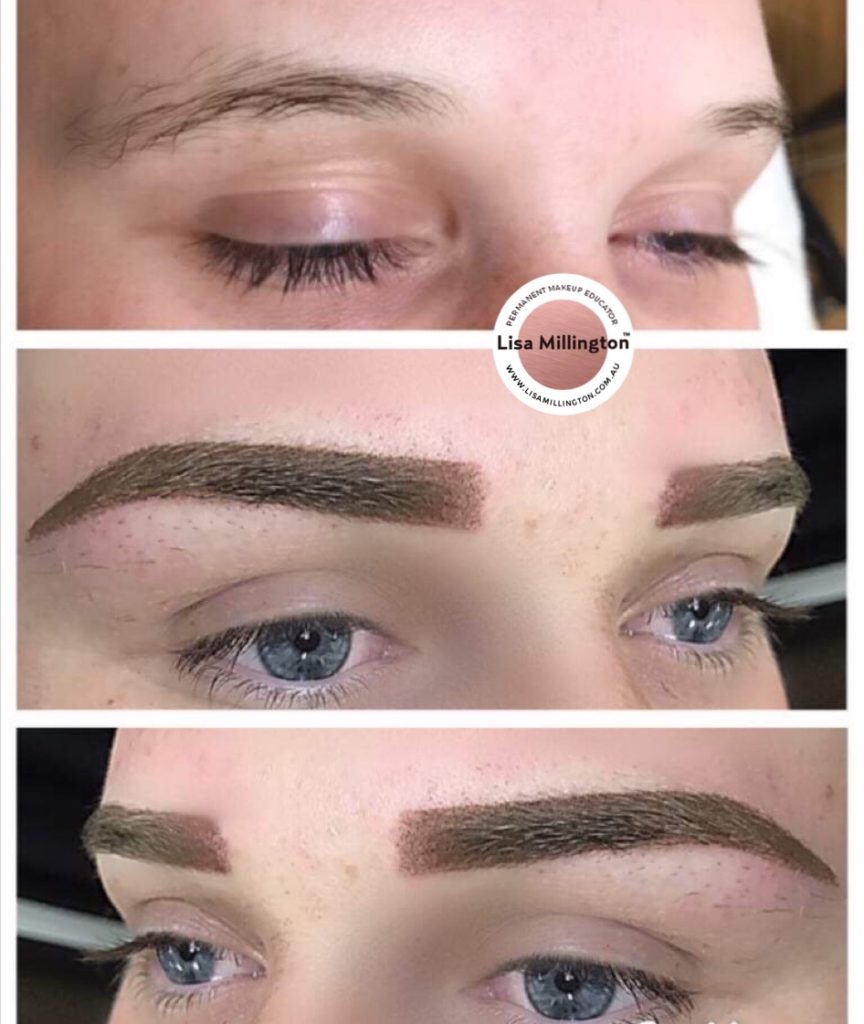 Brow Tattooing